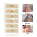 12pcs/set Foot Care Stickers Medical Plaster Chicken Eye Corns Patches