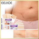 4pcs Silicone Scar Sheets Gel Strips Patch Adhesive Scar Removes (150mm)