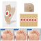 Wart Stick Wart Freeze Corn Removers For Feet Wart Remover Wart Remover Pads