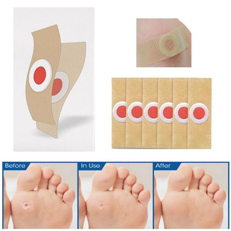 Wart Stick Wart Freeze Corn Removers For Feet Wart Remover Wart Remover Pads