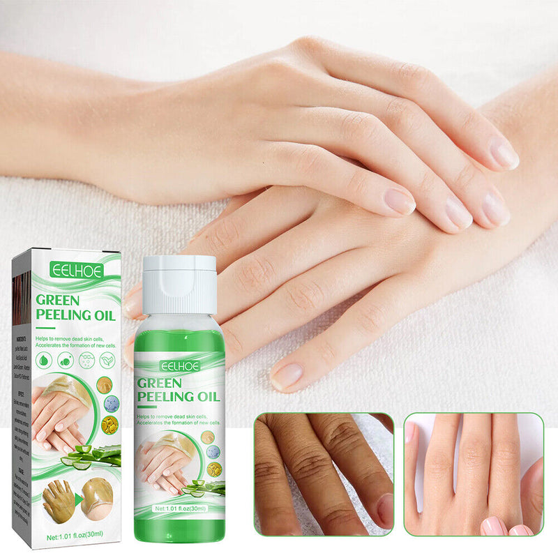 30ml Peeling Oil Lightening Acne Dark Patches Peeling Lotion Oil for Knee Ankle