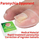 2Pcs Toe Nails Correction Ingrown Toenail Straightening Armor Clip V3F3