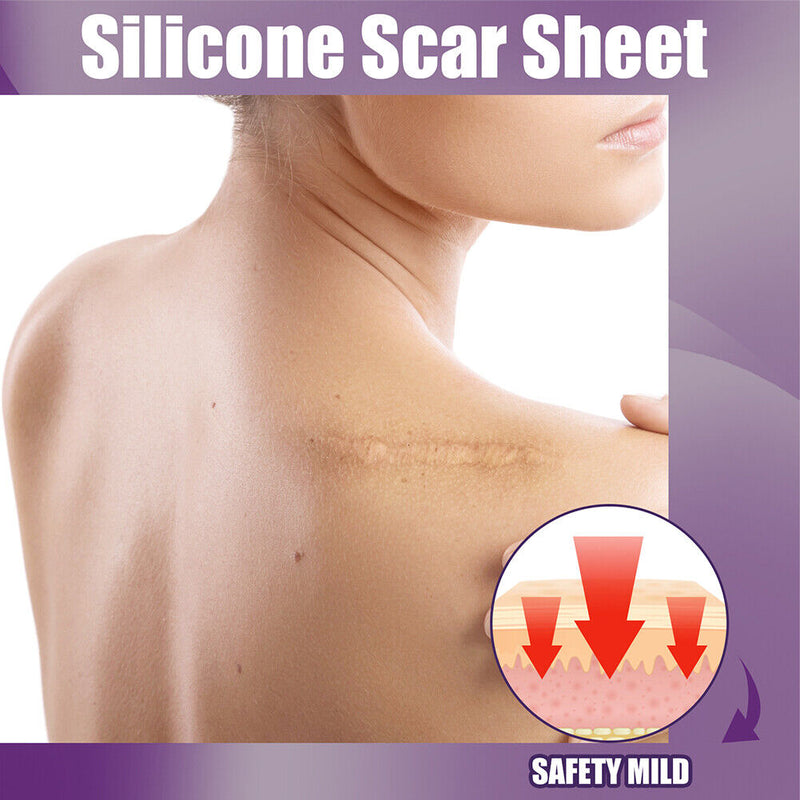 4pcs Silicone Scar Sheets Gel Strips Patch Reusable Scar Removes Remove Tra