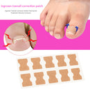 Paronychia Inlay Patch Painless Ingrown Toenail Correction Pedicure Nail Patch