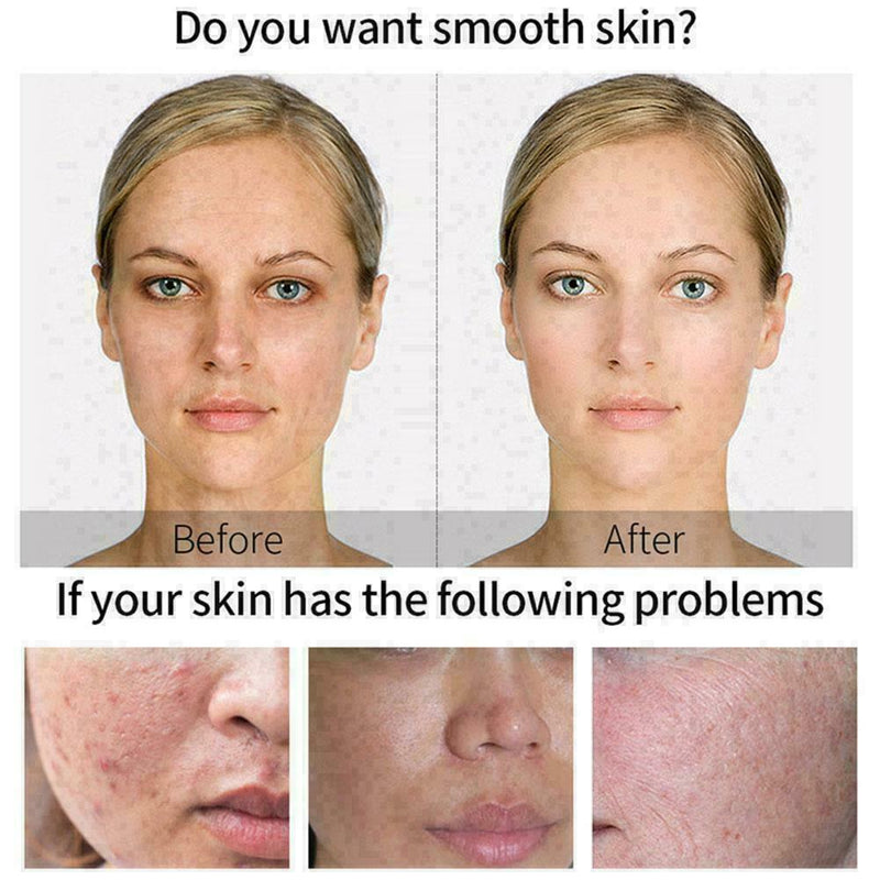 30ml Skin Whitening Lightening Brightening Serum Dark I2R7 Spot K8Y4 C6C5