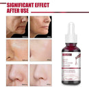 Fruit Salicylic Acid Essence, Anti-Acne Exfoliating SkinCare Shrink Pores T2G3