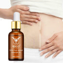 Stretch Marks Remover Essential Oil Eliminate Pregnancy Scars Maternity X7Y9