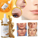 30ML Turmeric Face Serum Turmeric Dark Spot Corrector Serums Corrector Remover~