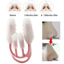 Nose Up Clip Bridge Lifting Shaping Straightening Corrector Tool S3 f4 M1M9