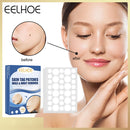 144pcs Skin Tag Remover Patches Wart Treatment Herbal Stickers Plasters Newly