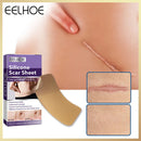 Self-Adhesive Scar Repair Stickers Silicone Scar Invisible Pad for Skin Beauty