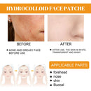 Tag Remover Patch Ance Pimple Patches Acne Spot Treatment Hydrocolloid Master