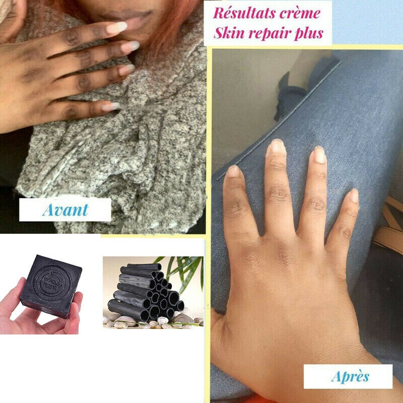 Women Private Intimate 100g Bamboo Charcoal Vagina Whitening Soap Skin Cleansing