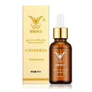 Essential oils For Stretch Marks Remover Strong Strength S5V5 Mark Removes U4T7