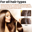 Instant Hair Regrowth Shampoo Hair loss Prevention Shampoo Anti Hairs Loss{