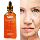 100ML Blood Orange Moisture Essence Hyaluronic Acid Anti-oxidation CA O4V0