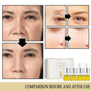 Facial Repair Anti-Falten Serum Lighting Fältchen Nasal Lines Firm Skin Essence.