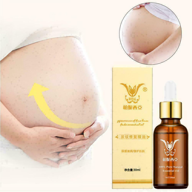 Essential oils For Stretch Marks Remover Strong Strength S5V5 Mark Removes U4T7