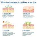 40 Capsules Acne Remover Patches Spot Scar Care Treatment K0T3 J4U2 L4V8 P7R9