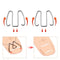 Easy To Use Correct Multiple Pedicure Front Hook Toenails Orthotics Rubber Band