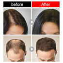 Anti-Hair Loss Cleaning Soap Floral Scent Rice Shampoo Soap Hair Wash Rice Soap
