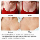 Silicone Self-Adhesive Transparent and Firm Skin Triangle Patch K0W0 T5E6