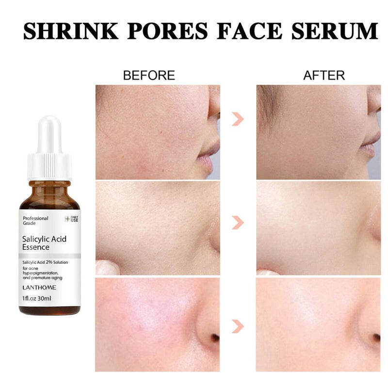Salicylic Acid Essence Shrink Pores Face Serum Moisturizing Nourish Skin Care/