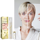 Protein Thread Lifting Face Filler Absorbable Collagen Protein Thread Firming