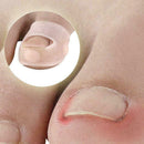 1 Pair Silicone Ingrown Toenail Correction Tool Invisible Toe N6I9 C5L1 M0A0