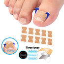 Ingrown Toenail Pedicure Patch Painless Paronychia Fixer Recover Foot Care Tool