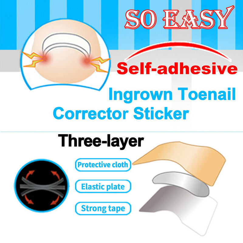 Ingrown Toenail Correction Fixer Recover Nail Patch Kit Foot Care Stickers Tool