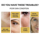Face Essence Collagen Protein Thread Firming Face Filler Absorbable Thread
