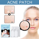 80pcs Acne Patches Pimple Remover Invisible Spot Stickers Facial Care Beauty