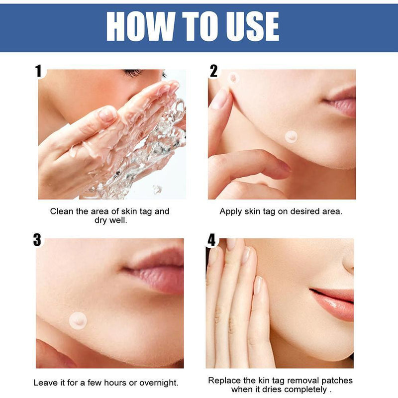 Mole Remover Patch Breathable Warts Invisible Stickers Cleaning Care (144pcs)