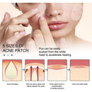 Pimple Patches Hydrocolloid Master Skin Tag Remover Patch Acne Spot Treatment