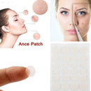 Cosrx Acne Pimple Master Patch 24 Patches Face Spot Treatment Scar Care G0K1