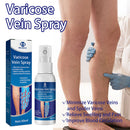 Varicose Vein Spray Improve Blood Circulation Soothing Leg Acid Bilges Itch