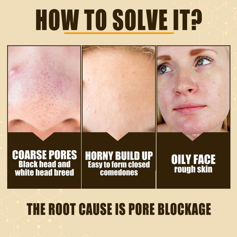 Lactobionic Acid Shrink Pores Essence Exfoliating Moisturizing Smooth Pores: