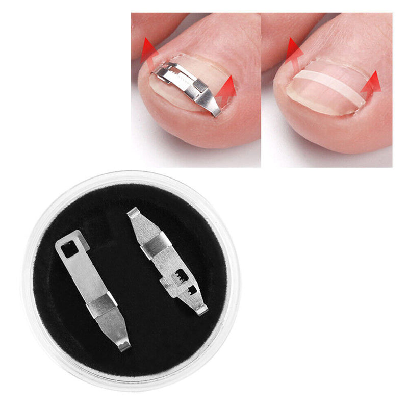 1 Pair Stainless Steel Ingrown Toe Nail Fixer Embed Toenail Correction Lifter