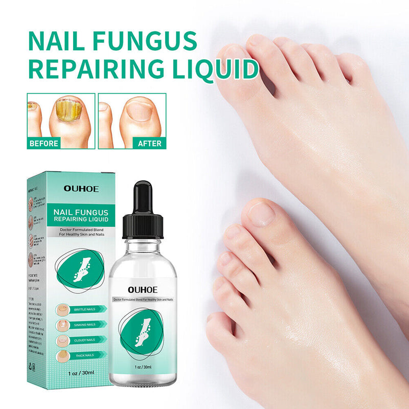 Toenail Fungus Oil Nail Repair Liquid for Fingernails Whitening Toe Feet Ca