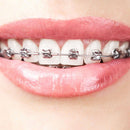Dental Orthodontic Treatment Mini Metal Ceramic Bracket 022MBT 345 Hooks