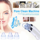 Facial Acne Blackhead Remover Vacuum Suction Pore Clean Machine (White A)