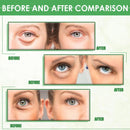 Herbal Golden Vision Eye Patch for Eye pressure Eye Fatigue & Dryness`