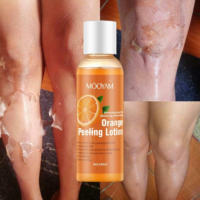 Orange Peeling Gel Skin Finger Knee Darkness Brighten Whitening Body K9B0