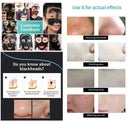 Off Black Nose Face Care Blackhead Remover Bamboo Charcoal Remove black dots