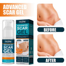 Advanced Scar Remove Acne Smoothing Whitening Moisturizing Cell Regeneration