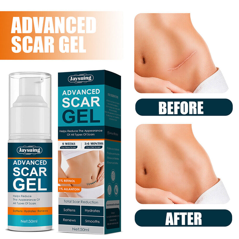 Advanced Scar Remove Acne Smoothing Whitening Moisturizing Cell Regeneration
