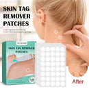 120pcs Skin Tag Remover Patch Maintenance Treatment Stickers Quick Absorb Plaster Tools