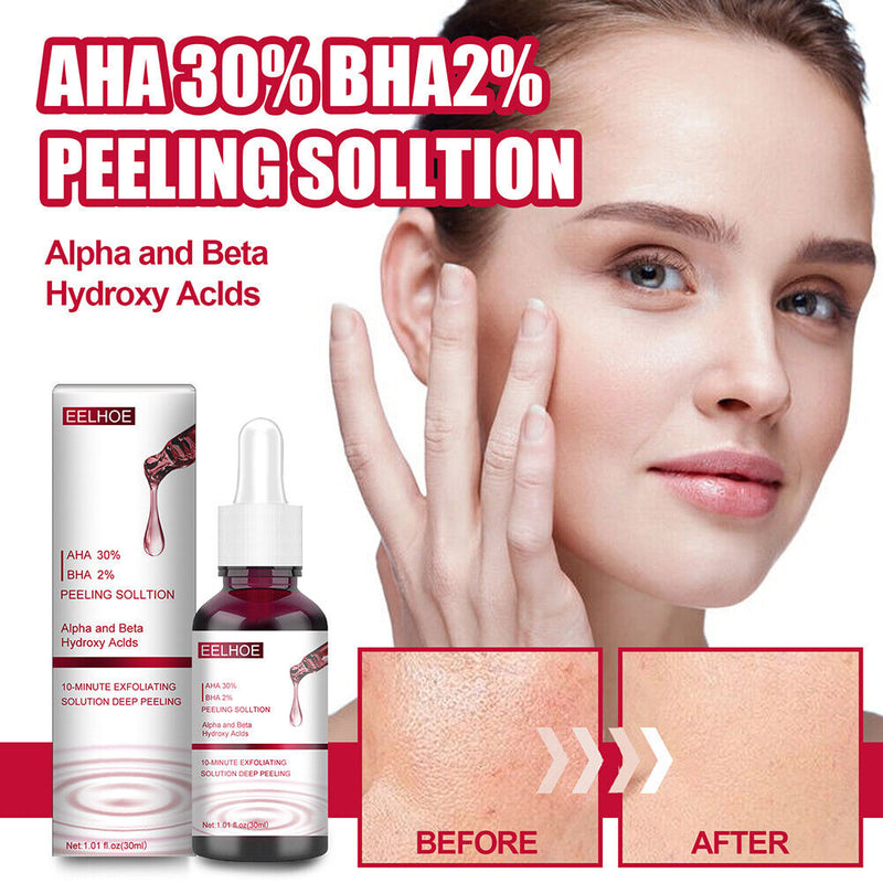 Salicylic Acid Serum AHA30% BHA 2% Shrink Pores Facial Care Serum for Women