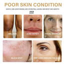 30ML Turmeric Face Serum Turmeric Dark Spot Corrector Serums Corrector Remover~